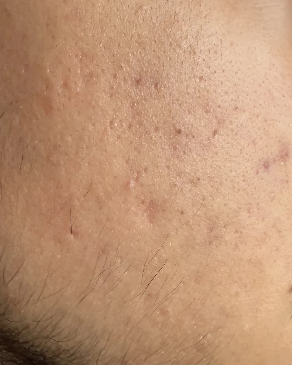 Client photo, after