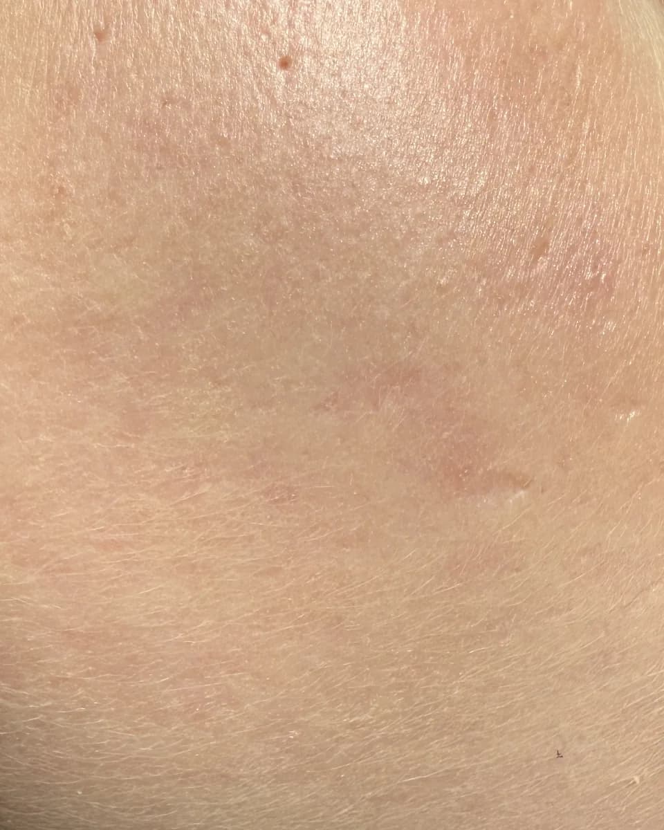 Client photo, after