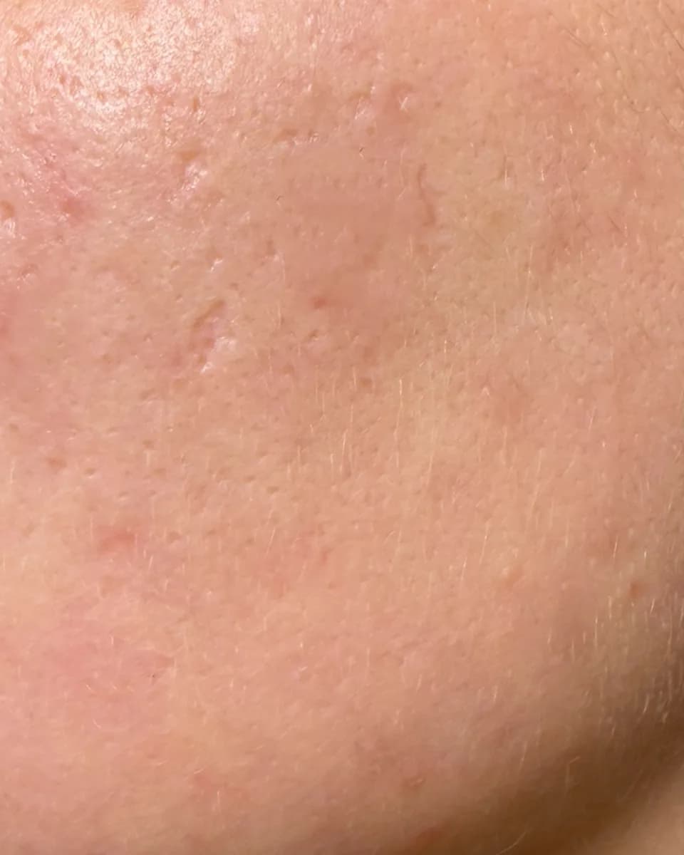 Client photo, after